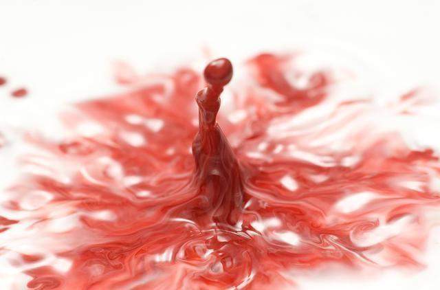 血液粘稠,在医学上叫做高粘稠血症,是心血管病的前兆.