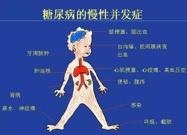 失明人口数_眼睛失明图片(3)