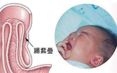 新生宝宝最易患上的7种常见病, 家长多留意宝宝少遭罪!735 / 作者:疾控客服 / 帖子ID:207576 新生宝宝最易患上的7种常见病, 家长多留意宝宝少遭罪!735 / 作者:疾控客服 / 帖子ID:207576