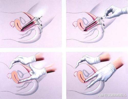 产检小知识: 产检为什么是盆腔检查? 附孕期产检时间内容表