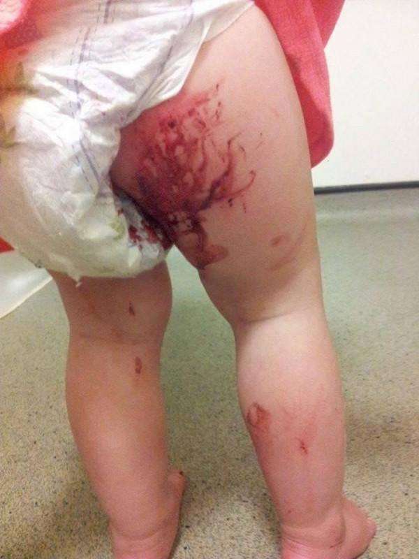 小女孩带着满是血迹的尿布跑向母亲,妈妈不敢相信发生
