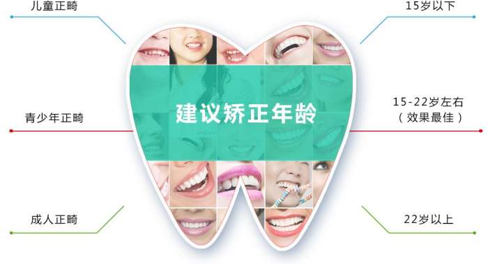 儿童牙齿矫正为什么要趁早?