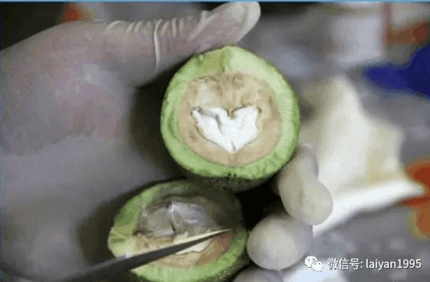 有喝过青核桃泡酒的吗, 核桃皮泡酒缓解胃痛、