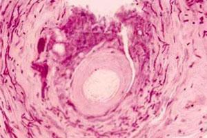 26岁女子下身总是“痒的慌”, 查出原因后, 女子捂脸不敢相信!