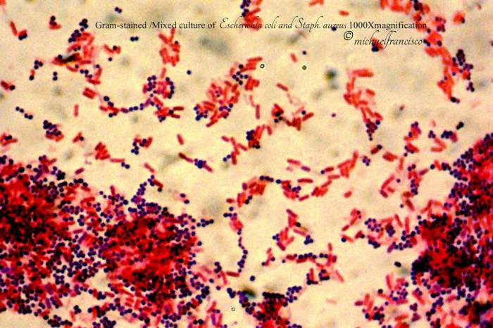 它是一种革兰氏阴性菌,经过革兰氏染色后在光学显微镜下呈红色.