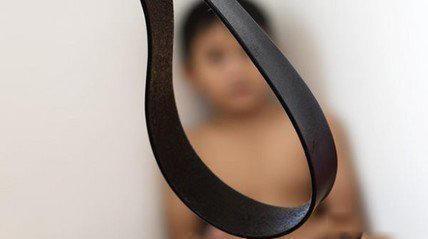 9岁男孩查出肾衰, 终身透析, 医生提醒: 孩子的屁股“碰”不得!