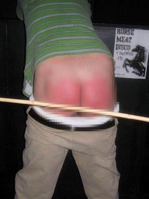 9岁男孩查出肾衰, 终身透析, 医生提醒: 孩子的屁股“碰”不得!