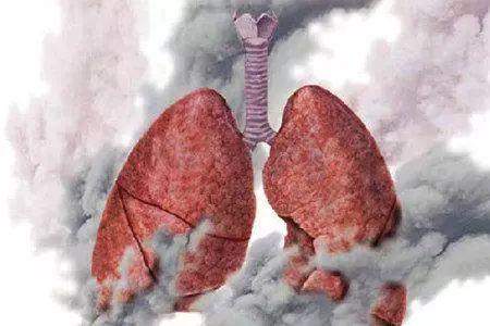 吸烟者, 出现4大症状, 马上戒烟, 否则, 就是在拿生命开玩笑!