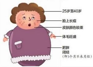 多囊卵巢患者应如何健康饮食? 多囊卵巢患者应如何健康饮食?