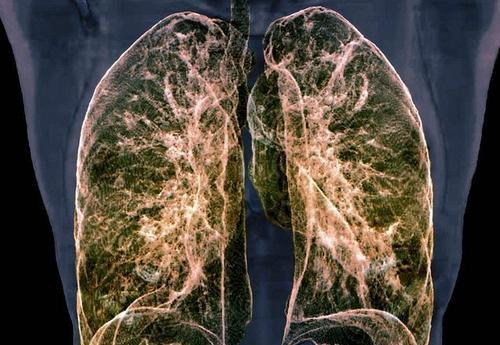 肺是重要的呼吸器官，也容易出现问题，若有这些表现，也要警惕