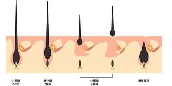 脂溢性脱发？还是女生，可以自愈吗？