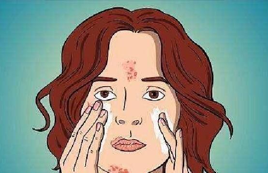 嘴唇下方总起白色小疙瘩,甚至还连成一片,会不会是螨虫? 嘴唇下方总起白色小疙瘩,甚至还连成一片,会不会是螨虫?