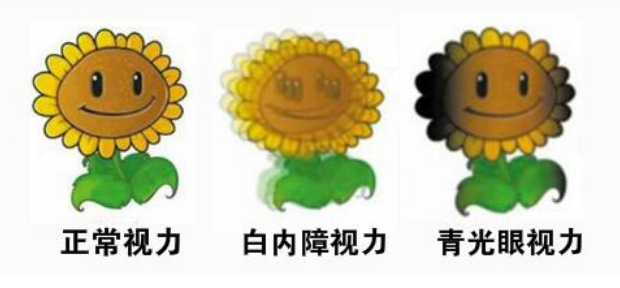 青光眼和白内障手术为什么可以一起做？