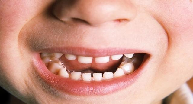 宝宝牙缝越长越宽是咋回事？孩子发育有规律，家长们先别着急