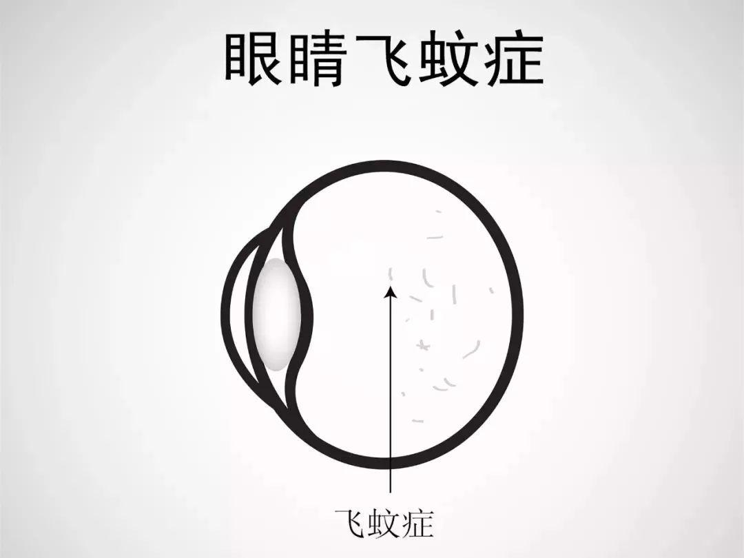 常见的眼部疾病有哪些?别急,看这里 常见的眼部疾病有哪些?别急,看这里