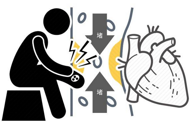 为何高血脂越来越多?医生:少碰3物,少做3事,血管会感激你! 为何高血脂越来越多?医生:少碰3物,少做3事,血管会感激你!