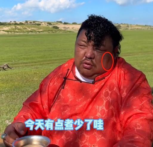 “油亡爷”恩克请客吃肉肠,被指黑斑扩散,网友:坐等大结局