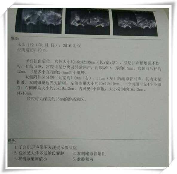 双侧输卵管堵塞不孕13年 今携宝贝为不孕姐妹们打气