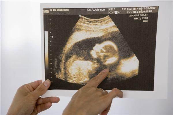 孕期内如何预防胎儿畸形? 准妈妈们只要做好这