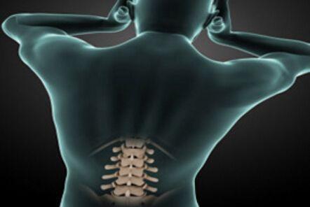 老中医告诉你, 腰间盘突出治疗的秘方! 快给家