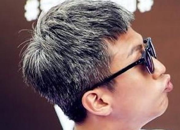 年少长白头发真相不是衰老, 而是身体缺了这一