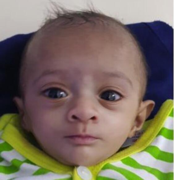 宝宝出生只有400克, 迷你宝宝顽强生存 见证生命奇迹