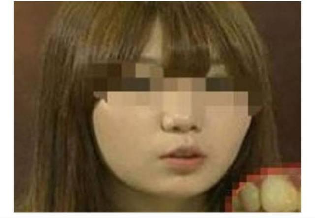 20岁女子10年不刷牙, 口臭无比, 没有男朋友