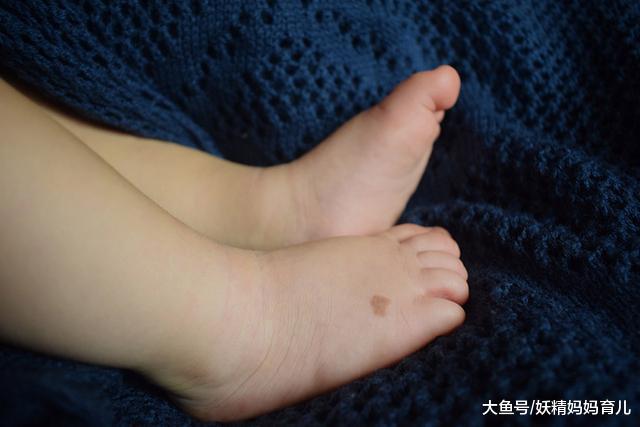 宝宝需要及时就医的7种状况, 你知道几个?