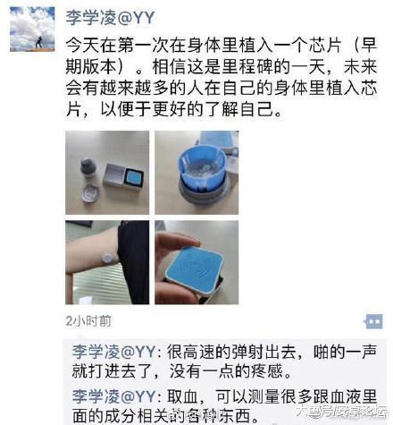 YY CEO李学凌自曝在身体植
