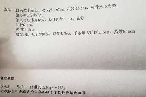 39周男宝如愿接到, 附上孕期症状姐妹们一观