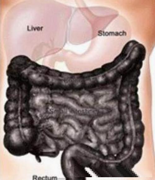 空腹喝 “它们”, 可以帮你排出陈年宿便, 有效去口臭身材变匀称
