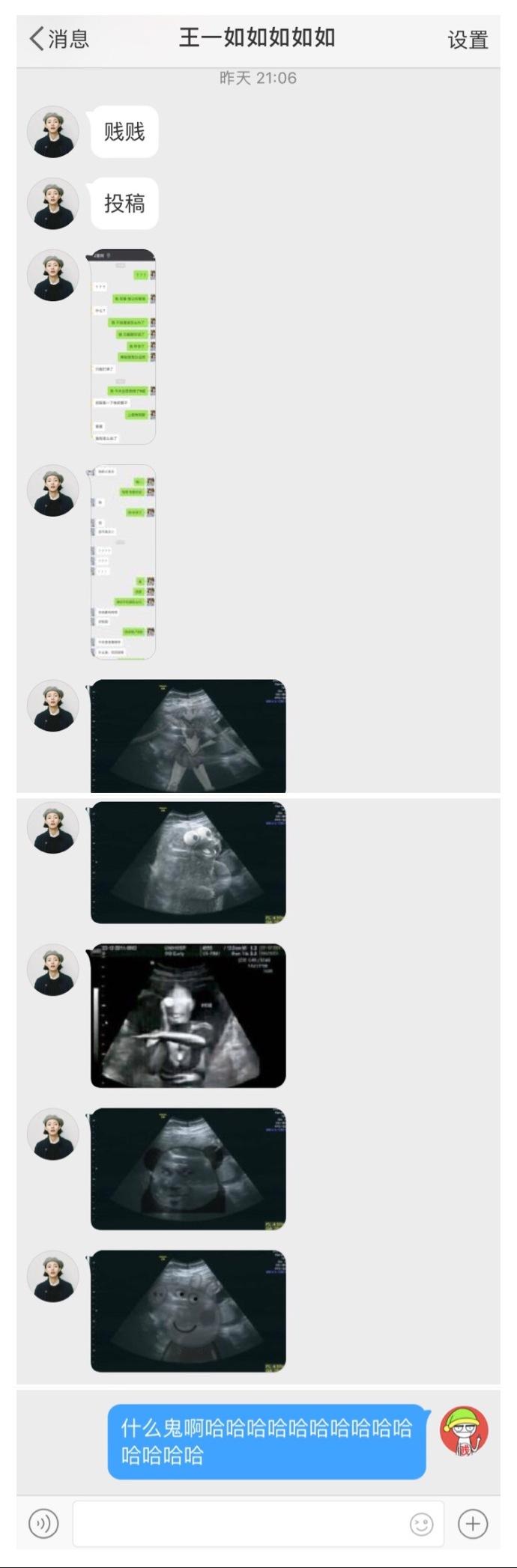 当你告诉自己的好朋友你怀孕了, 她们会有什么样的反应? ????