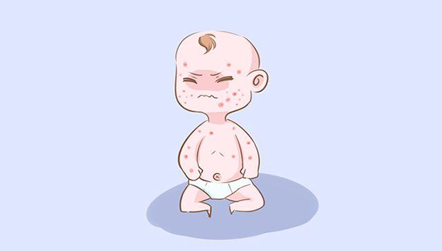 孕期宝妈在饮食方面注意这几点, 可以避免胎毒对宝宝的影响