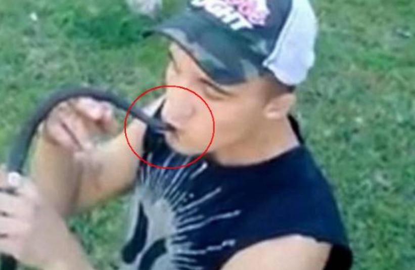 国外一男子酷爱毒蛇, 直播亲毒蛇时不小心被咬, 结果变成“猪头脸”