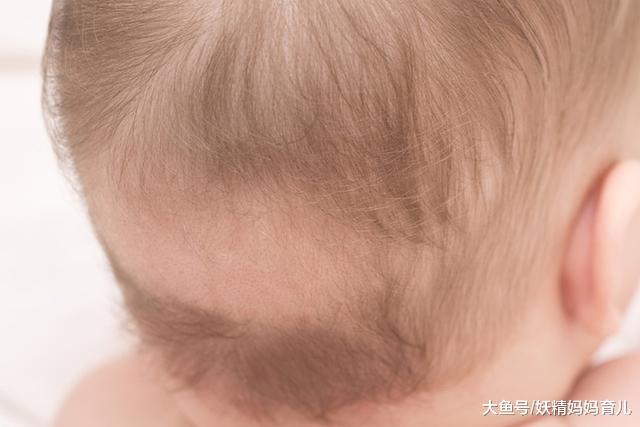 宝宝需要及时就医的7种状况, 你知道几个?