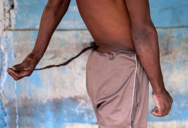 男子长着37厘米的尾巴, 每天爬树