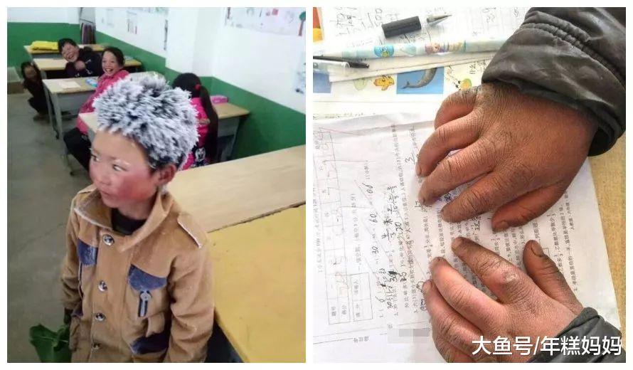 这些小细节不注意, 宝宝的皮肤可就毁了