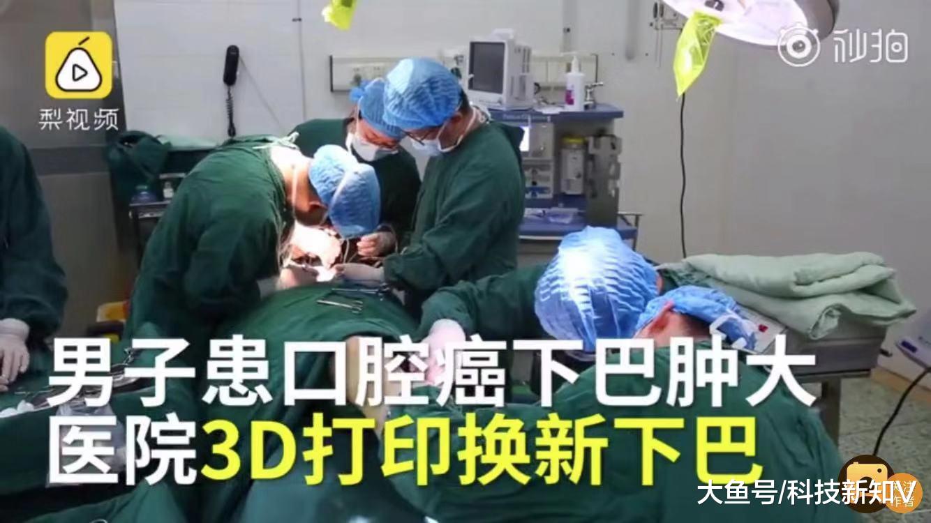 【男子患口腔癌，#医生用3D打