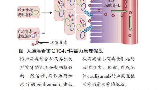 血浆置换或可改善腹泻相关溶血尿毒综合征病程