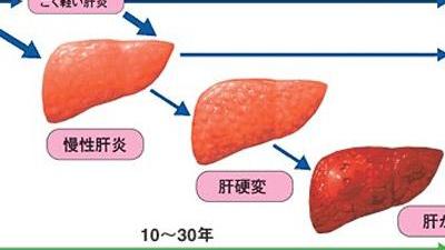 癌症早期的4个“破绽”,发现后一定要上心!