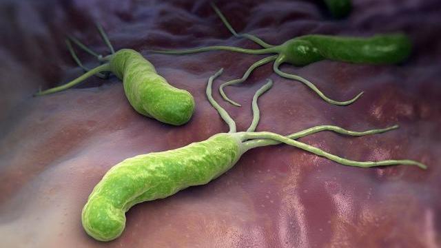 [幽门螺杆菌]医生们发现：感染幽门螺杆菌后，皮肤上会有一些“奇怪”的症状