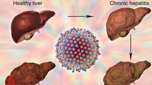 睡眠|肝开始变硬，身体会出现5种异常，若一个不占，说明肝还不错