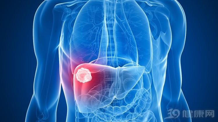 肝癌|肝癌“加速器”已公布，喝酒并未上榜，榜首是它，不少人仍在做