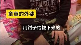 网友看哭！6岁女童遭亲妈及其男友虐待三个月险丧命，送医后曾被下病危通知书。