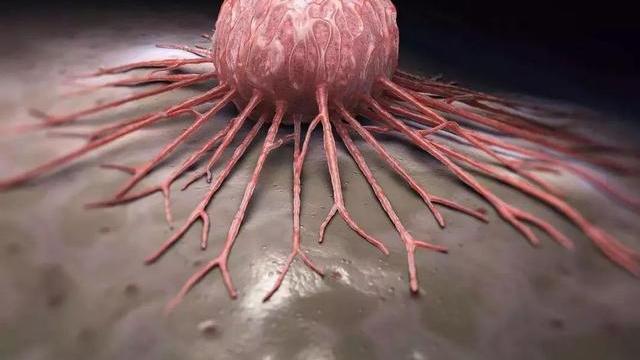 『肝脏』体内有癌，身体往往有四个标志，出现一个，也要抓紧就医