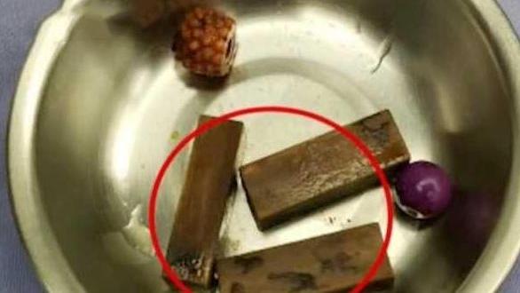 8岁女儿下体塞3块积木，妈妈却浑然不知