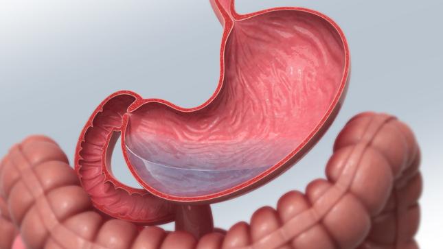 10个人有9个得胃病，从胃炎胃痛到治愈，用好硫糖铝可帮您！