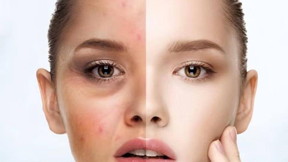 饮食 裸脸好吗？