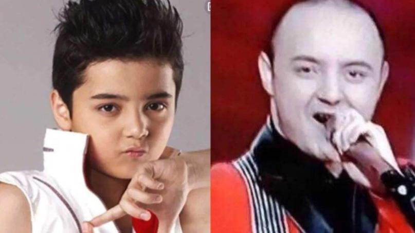 阿尔法|他5岁爆红，18岁秃顶被嘲大叔，今23岁逆袭成功打脸网友