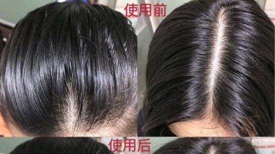 章子怡|油头救星！拯救了我长期油腻腻的头发，而且再也不会油光满脸了